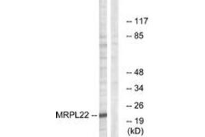 Image no. 1 for anti-Mitochondrial Ribosomal Protein L22 (MRPL22) (AA 91-140) antibody (ABIN1534525)