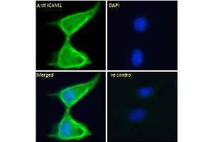 Image no. 3 for anti-Intercellular Adhesion Molecule 1 (ICAM1) (AA 313-327) antibody (ABIN2613438)