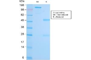 Image no. 1 for anti-Mucosa Associated Lymphoid Tissue Lymphoma Translocation Gene 1 (MALT1) (AA 701-808) antibody (ABIN6939113)