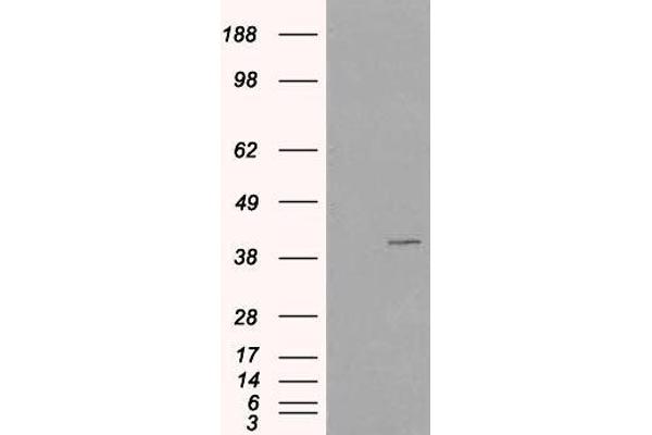 anti-Vacuolar Protein Sorting-Associated Protein 26A (VPS26A) (C-Term) antibody