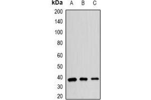 Image no. 1 for anti-Poly(rC) Binding Protein 2 (PCBP2) antibody (ABIN3198128)