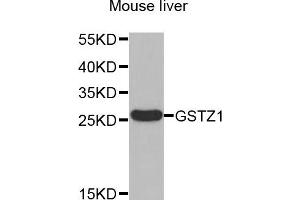 Image no. 1 for anti-Glutathione Transferase zeta 1 (Maleylacetoacetate Isomerase) (GSTZ1) antibody (ABIN1877115)