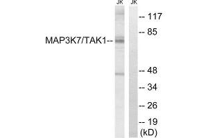 Image no. 2 for anti-Mitogen-Activated Protein Kinase Kinase Kinase 7 (MAP3K7) (Thr187) antibody (ABIN1848228)