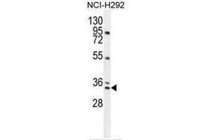 Image no. 2 for anti-A Kinase (PRKA) Interacting Protein 1 (AKIP1) (AA 61-91), (N-Term) antibody (ABIN950614)