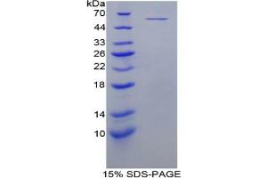 Image no. 1 for Protein L-Myc (MYCL) protein (ABIN3012201)
