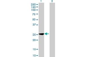 Image no. 1 for anti-Mitochondrial Ribosomal Protein L40 (MRPL40) (AA 1-206) antibody (ABIN528757)