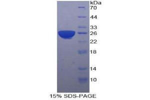 Image no. 1 for Pregnancy Specific beta-1-Glycoprotein 1 (PSG1) (AA 202-401) protein (His tag) (ABIN1880069)
