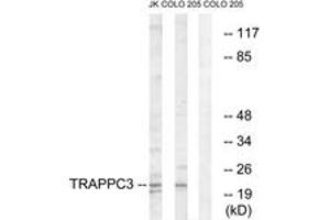 Image no. 1 for anti-Trafficking Protein Particle Complex 3 (TRAPPC3) (AA 131-180) antibody (ABIN1535413)