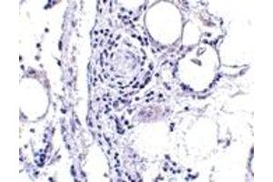 Immunohistochemistry (IHC) image for anti-Fatty Acid Binding Protein 7, Brain (FABP7) (Middle Region) antibody (ABIN1030929)