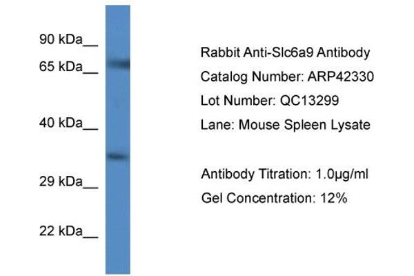 anti-Glycine Transporter 1 (GLYT1) (C-Term) antibody