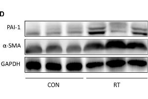 Image no. 36 for anti-Glyceraldehyde-3-Phosphate Dehydrogenase (GAPDH) antibody (ABIN3020541)