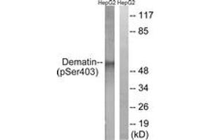 Western blot analysis of extracts from HepG2 cells treated with Insulin 0.