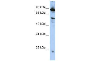 Image no. 1 for anti-Zinc Finger, CCCH-Type with G Patch Domain (ZGPAT) (N-Term) antibody (ABIN632082)