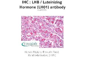 Image no. 1 for anti-Luteinizing Hormone (LH) antibody (ABIN4889867)