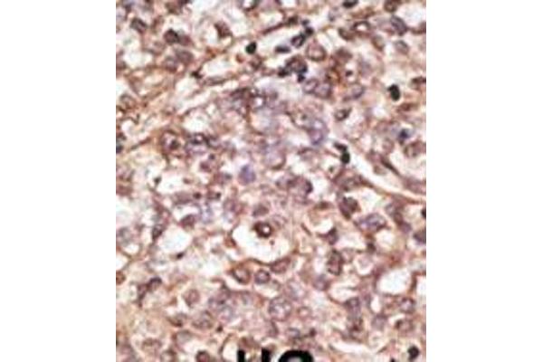 anti-Dickkopf Homolog 4 (Xenopus Laevis) (DKK4) (AA 188-217), (C-Term) antibody