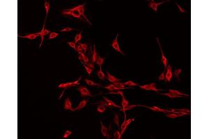 Image no. 1 for anti-Neuromedin S (NMS) (C-Term) antibody (ABIN6259268)