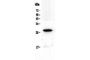 Image no. 3 for anti-Interleukin 15 Receptor, alpha (IL15RA) (AA 31-174) antibody (ABIN5519011)