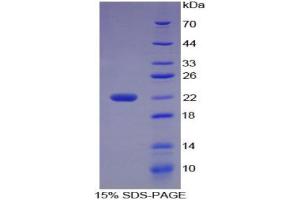 Image no. 1 for Microseminoprotein, beta (MSMB) (AA 19-114) protein (His tag) (ABIN1099297)