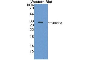 PKC mu Antikörper  (AA 651-876)