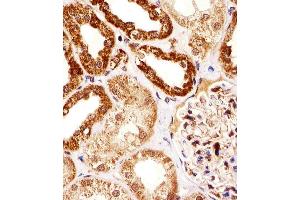 Image no. 1 for anti-Sjogren Syndrome Nuclear Autoantigen 1 (SSNA1) (AA 25-53), (N-Term) antibody (ABIN1881836)