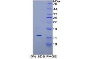 Image no. 1 for Platelet-Derived Growth Factor alpha Polypeptide (PDGFA) (AA 90-190) protein (His tag) (ABIN1880063)