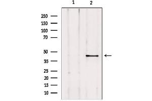 Image no. 1 for anti-A Kinase (PRKA) Anchor Protein 5 (AKAP5) (N-Term) antibody (ABIN6257661)