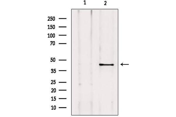 anti-A Kinase (PRKA) Anchor Protein 5 (AKAP5) (N-Term) antibody