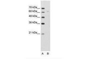 Image no. 2 for anti-Dihydrolipoyl Transacetylase (DLAT) (AA 61-110) antibody (ABIN203494)