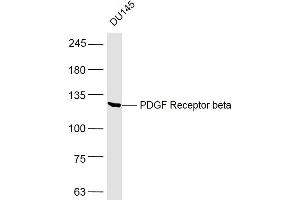 DU145 lysates probed with PDGF Receptor beta Polyclonal Antibody, Unconjugated  at 1:500 dilution and 4˚C overnight incubation.