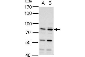 WB Image MDM2 antibody detects MDM2 protein by western blot analysis.