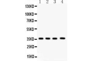 Image no. 5 for anti-PDZ Binding Kinase (PBK) (AA 71-322) antibody (ABIN3043592)