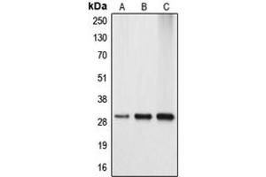 Image no. 2 for anti-Apolipoprotein A-I Binding Protein (APOA1BP) (Center) antibody (ABIN2705485)