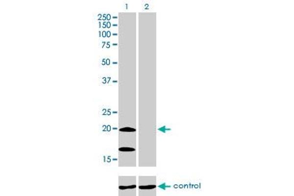 anti-NADH Dehydrogenase (Ubiquinone) Fe-S Protein 4, 18kDa (NADH-Coenzyme Q Reductase) (NDUFS4) (AA 66-175) antibody