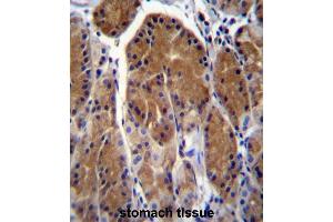 Image no. 1 for anti-Testis-Specific Serine Kinase 6 (TSSK6) (AA 197-228), (C-Term) antibody (ABIN955365)