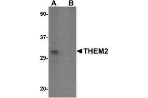 Image no. 2 for anti-Acyl-CoA Thioesterase 13 (ACOT13) (C-Term) antibody (ABIN500903)