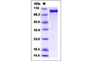 Image no. 1 for Optineurin (OPTN) (AA 1-577) protein (GST tag,His tag) (ABIN2006196)