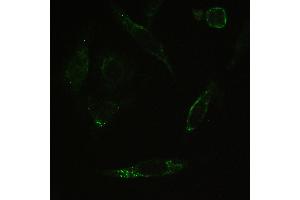 Image no. 3 for anti-Myosin Phosphatase, Target Subunit 1 (PPP1R12A) (AA 1-40), (N-Term) antibody (ABIN3043902)