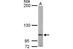 Image no. 3 for anti-Eukaryotic Translation Initiation Factor 4 gamma 2 (EIF4G2) (N-Term) antibody (ABIN2855137)