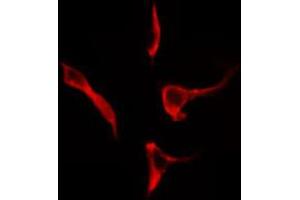 Image no. 1 for anti-Receptor Tyrosine-Protein Kinase ErbB-3 (ERBB3) (pTyr1328) antibody (ABIN6271266)