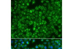 Immunofluorescence analysis of A549 cells using MTMR4 Polyclonal Antibody
