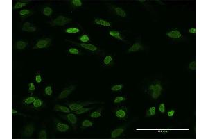 Immunofluorescence of monoclonal antibody to NHS on HeLa cell.