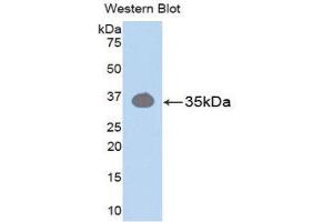 Pkc beta 1 Antikörper  (AA 342-600)