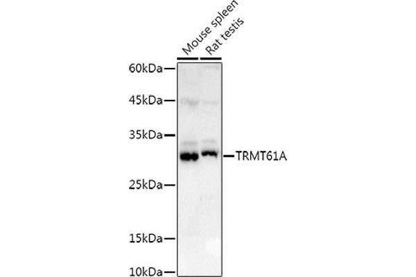 TRMT61A 抗体  (AA 1-289)