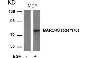 MARCKS antibody  (pSer170)