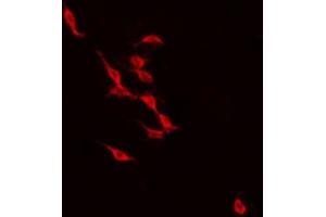 Image no. 3 for anti-Recoverin (RCVRN) antibody (ABIN6257479)