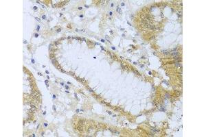 Immunohistochemistry of paraffin-embedded Human stomach using ACP1 Polyclonal Antibody at dilution of 1:100 (40x lens).