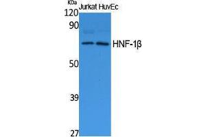 Anti Hnf1b Anticorps N Term Produit Abin