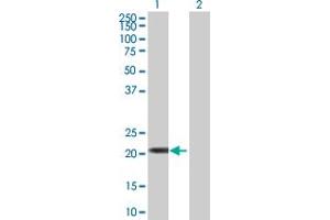 Image no. 1 for anti-Tripartite Motif Family-Like 1 (TRIML1) (AA 1-192) antibody (ABIN531638)