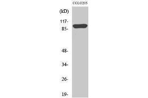 Image no. 1 for anti-Proteasome (Prosome, Macropain) 26S Subunit, Non-ATPase, 2 (PSMD2) (N-Term) antibody (ABIN3186586)