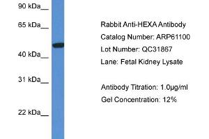Image no. 1 for anti-Hexosaminidase A (HEXA) (C-Term) antibody (ABIN2788673)